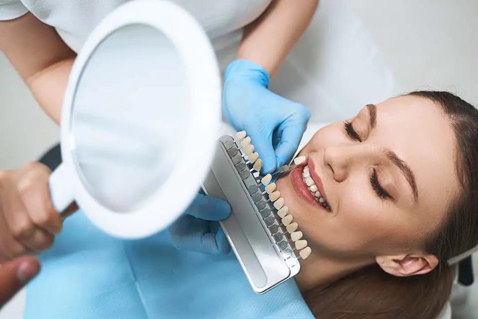 Factors That Influence Veneers Cost