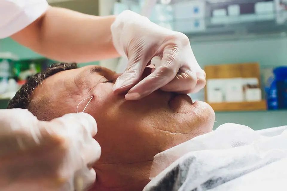 Factors That May Influence Under Eye Filler Cost